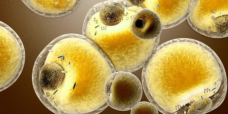 Understanding Triglycerides: Key Causes and Management Strategies 